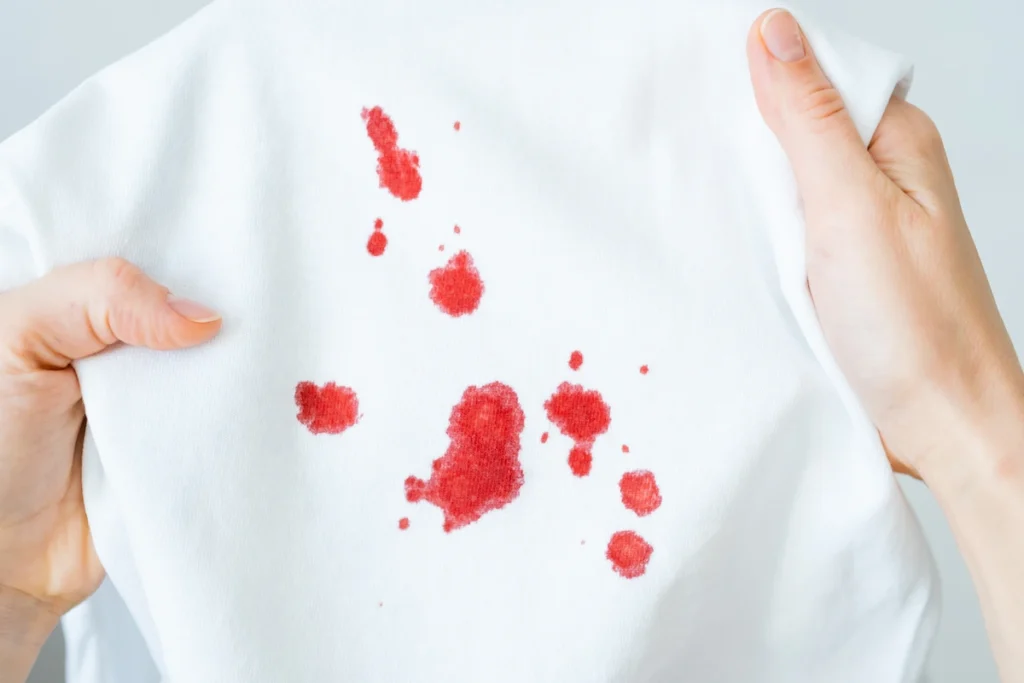 cara menghilangkan noda darah yang sudah kering