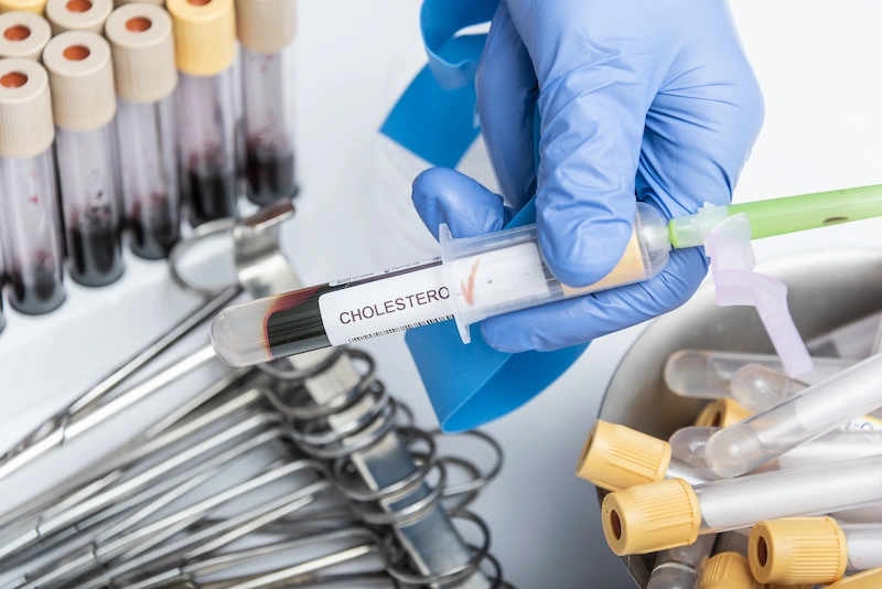 kadar kolesterol normal