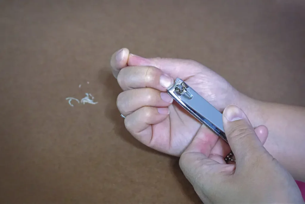 kuku yang panjang dan kotor menyebabkan