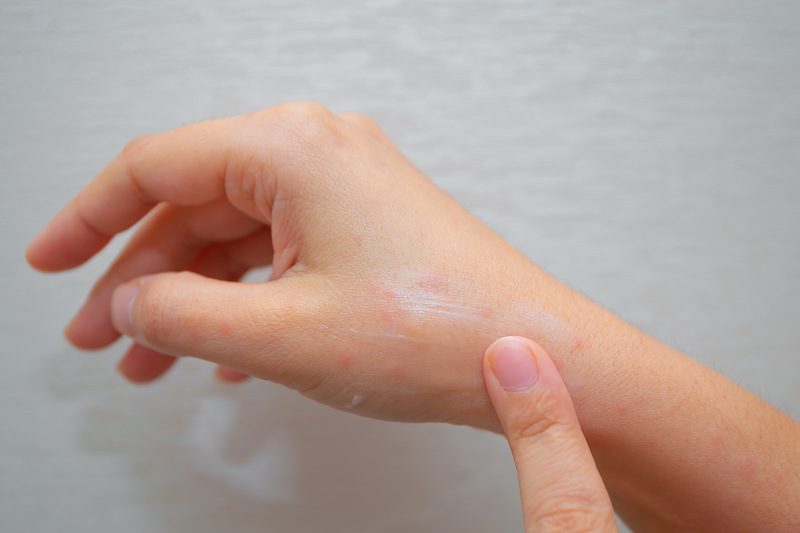 lotion nyamuk untuk anak